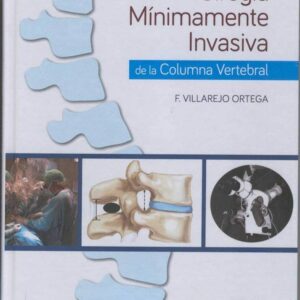 CIRUGIA MINIMAMENTE INVASIVA